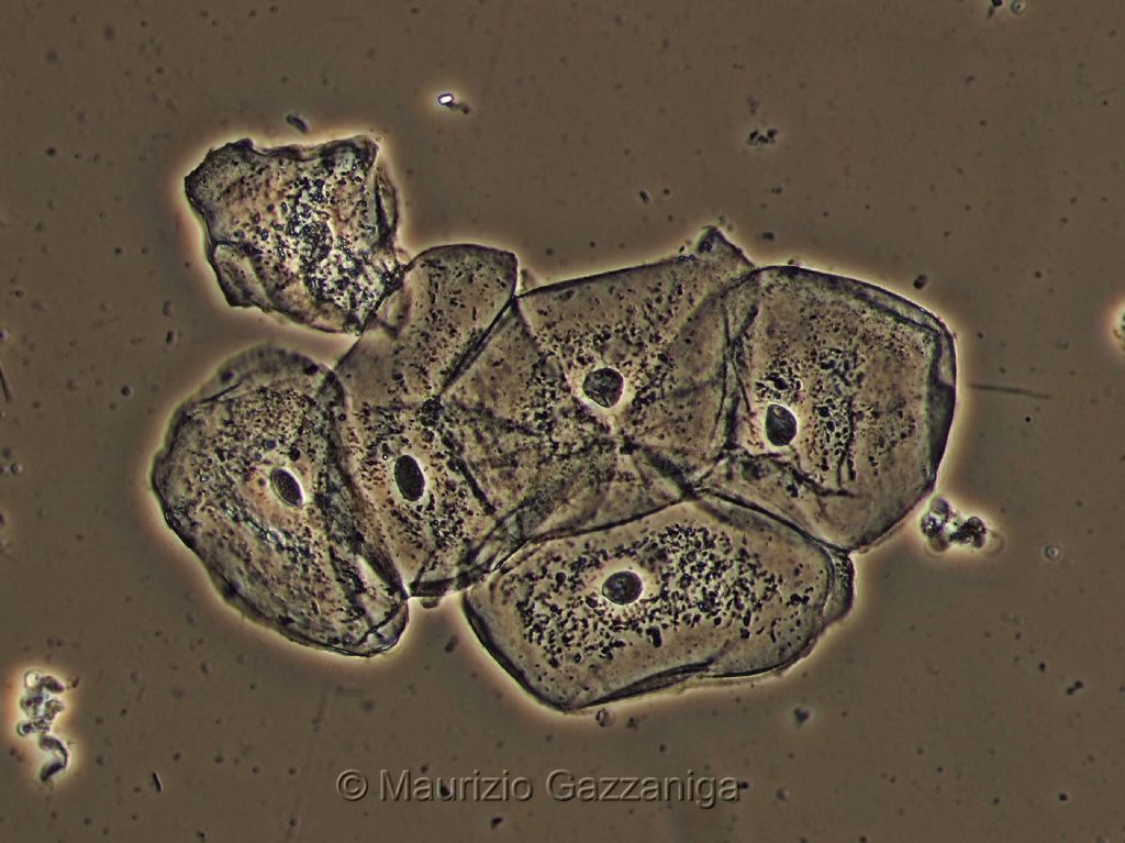 Cellule epiteliali